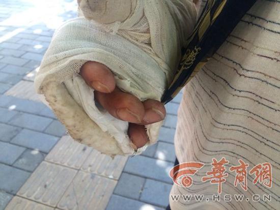 �Ύ�����5�³��ڵ��P�h��ӭ�e����ɻ�r�܂��ģ���(d��ng)����ؓ؟(z��)���b·�ϵ�ˮ�������܇�����ӵ�����r������������ץ���������A(y��)�O(sh��)�õ�λ����ţ���֪��ε�܇�͵ض���һ���������S֮һ�ᣬ�Ύ������ִ�Ĵָ��СĴָͬ�r���A�ڃɸ��������g����(d��ng)�����ˡ�